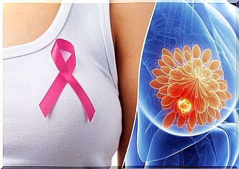 10 breast cancer warning signs