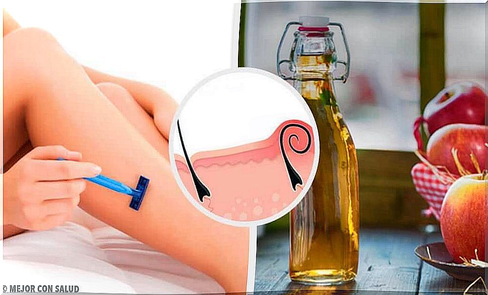 5 natural remedies for skin irritation after shaving