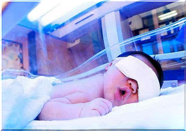 Baby gets phototherapy