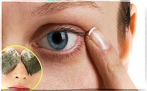 Remedies for dark circles under the eyes