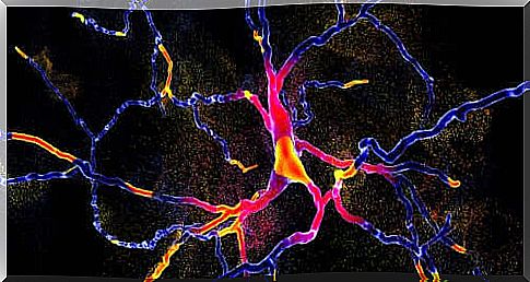 Diagnosing multisystem atrophy with new technology