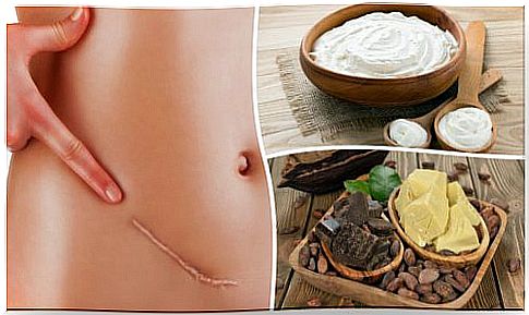 The 7 Best Natural Treatments For Scars