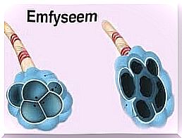 emphysema