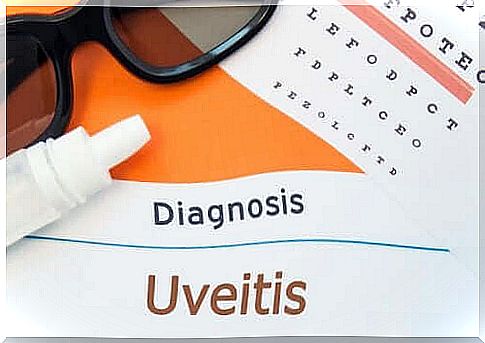 What are the symptoms of uveitis?