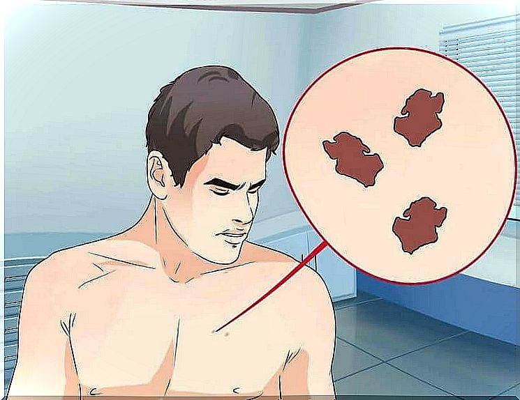 What do you do if you find an abnormal spot?