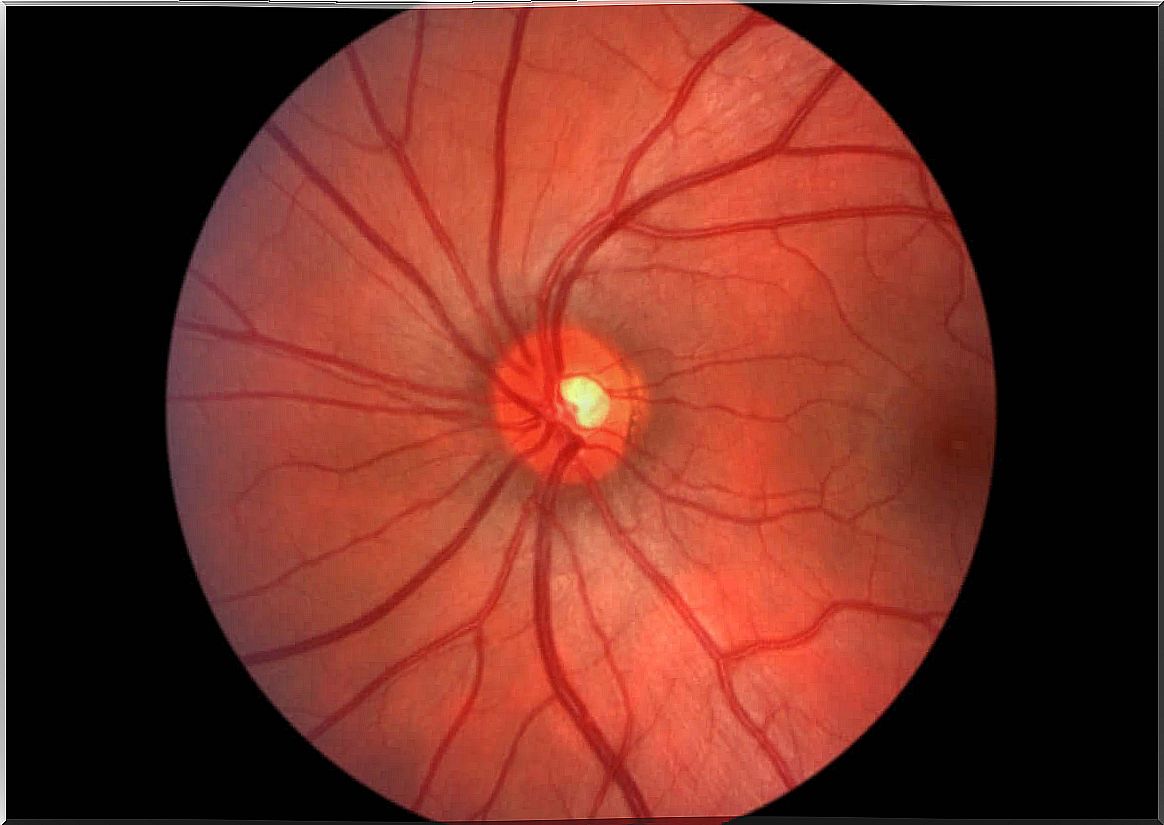 Fundus of the eye